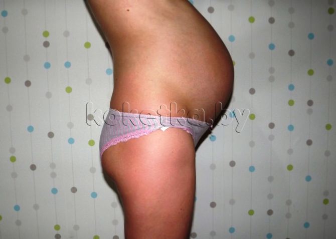 Фото беременной женщины - беременность 28 недель