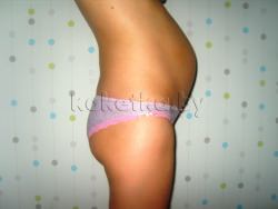 Фото беременной женщины - беременность 21 неделя