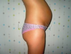 Фото беременной женщины - беременность 24 недели