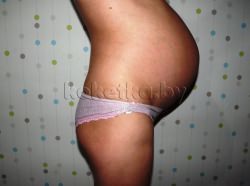 Фото беременной женщины - беременность 37 недель