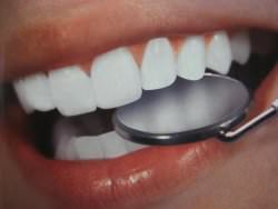 Имплантация зубов: преимущества метода