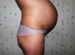 Фото беременной женщины - беременность 36 недель