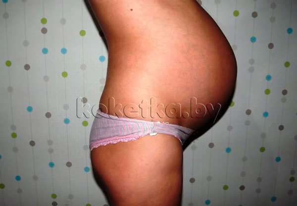 Фото беременной женщины - беременность 37 недель