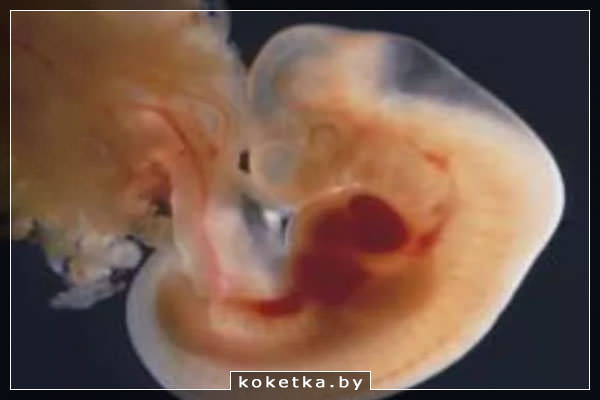 Эмбрион на 3 акушерской неделе беременности