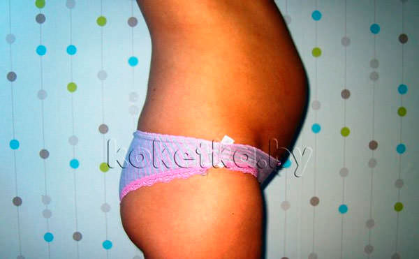 Фото беременной женщины - беременность 18 недель