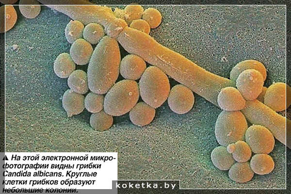 Фото грибков кандида под микроскопом