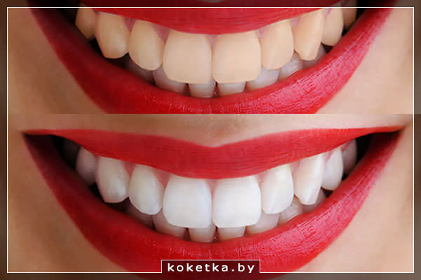 Красивые белые зубы