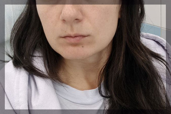 До увелиичения губ