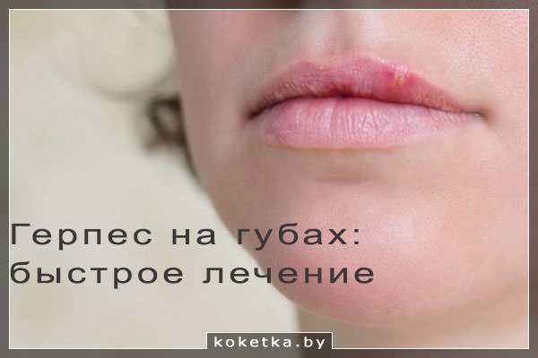 Герпес на губах: причины, особенности протекания заболевания, лечение, возможные осложнения